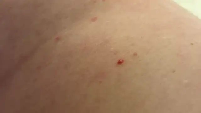 andrenoma427 online show from January 2026 03:23:01 AM